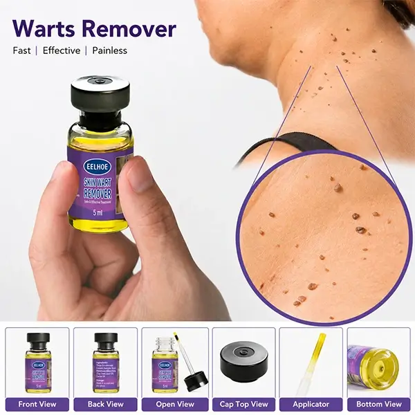 SKIN WART REMOVER